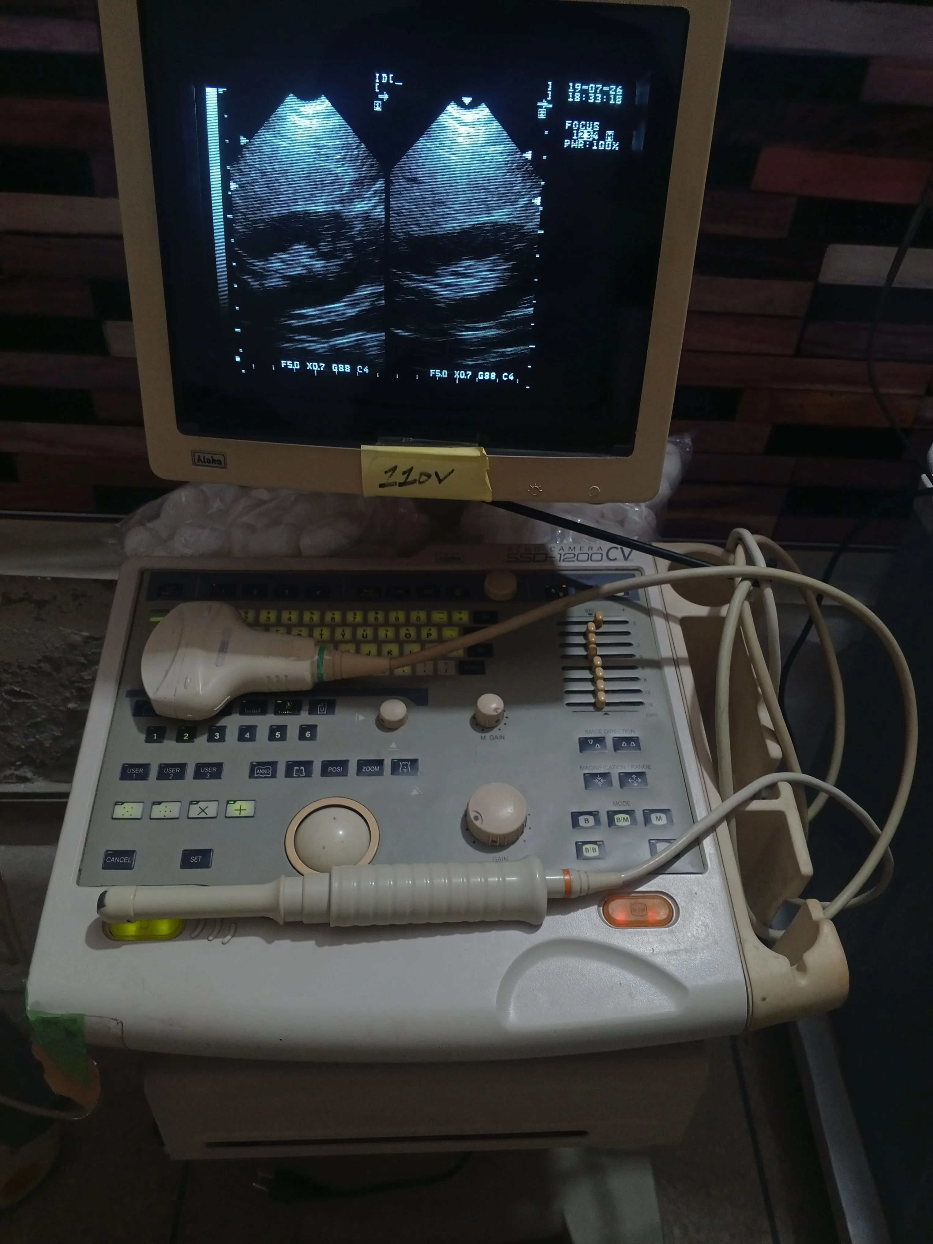 Healthcare & Medical ultrasound machine