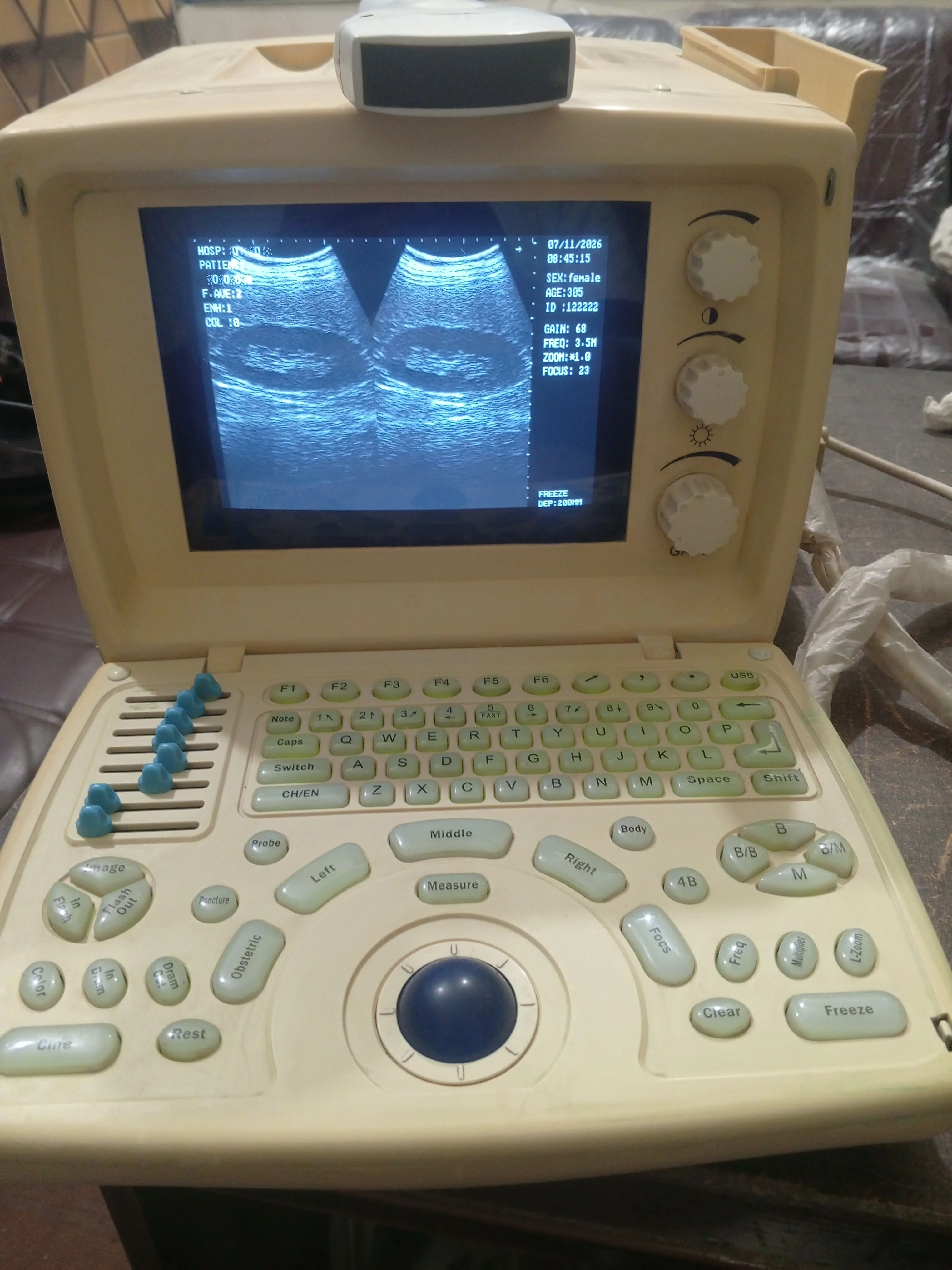 Portable ultrasound machine for sale