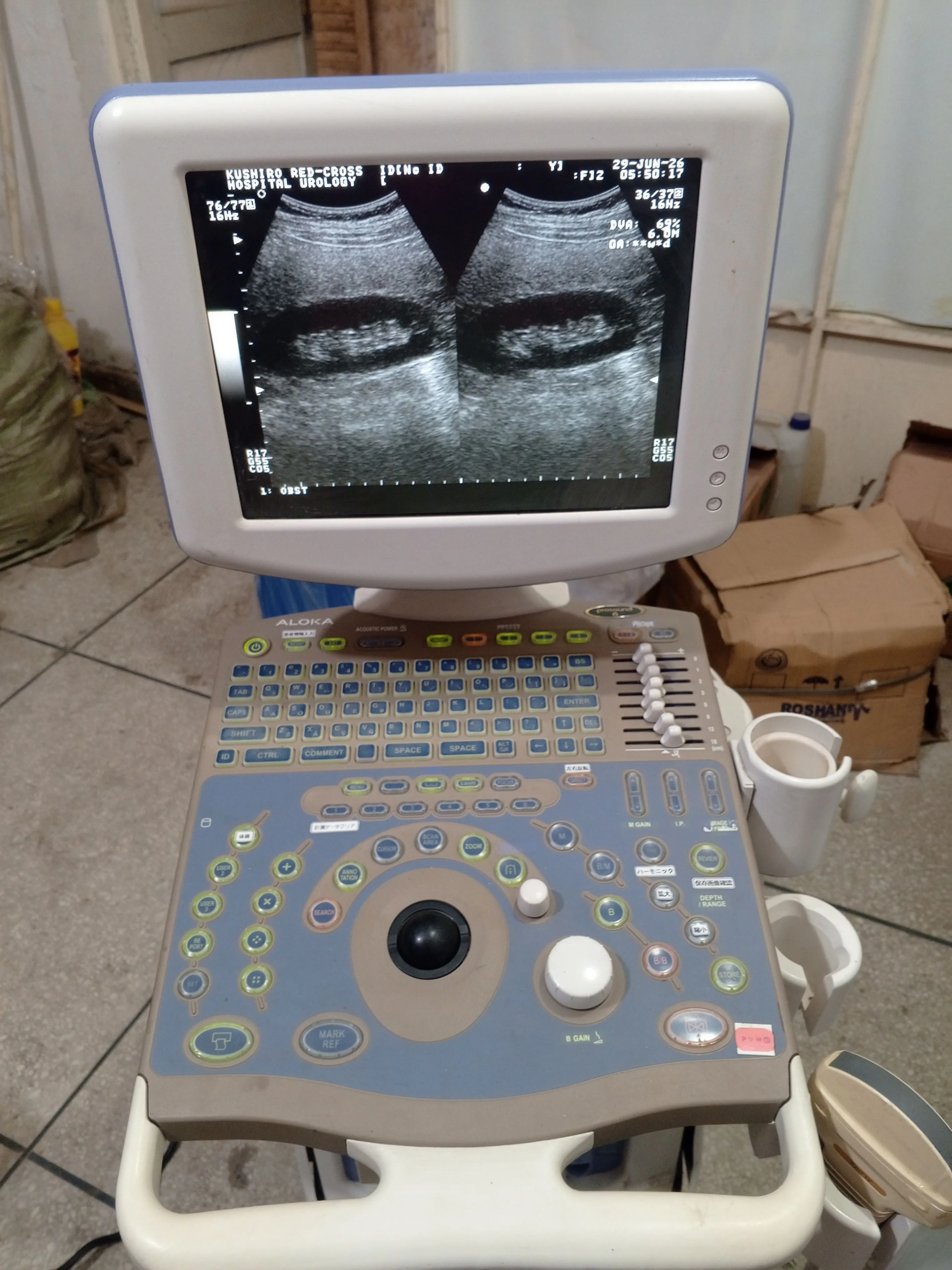 Aloka prosound 6 ultrasound machine for sale