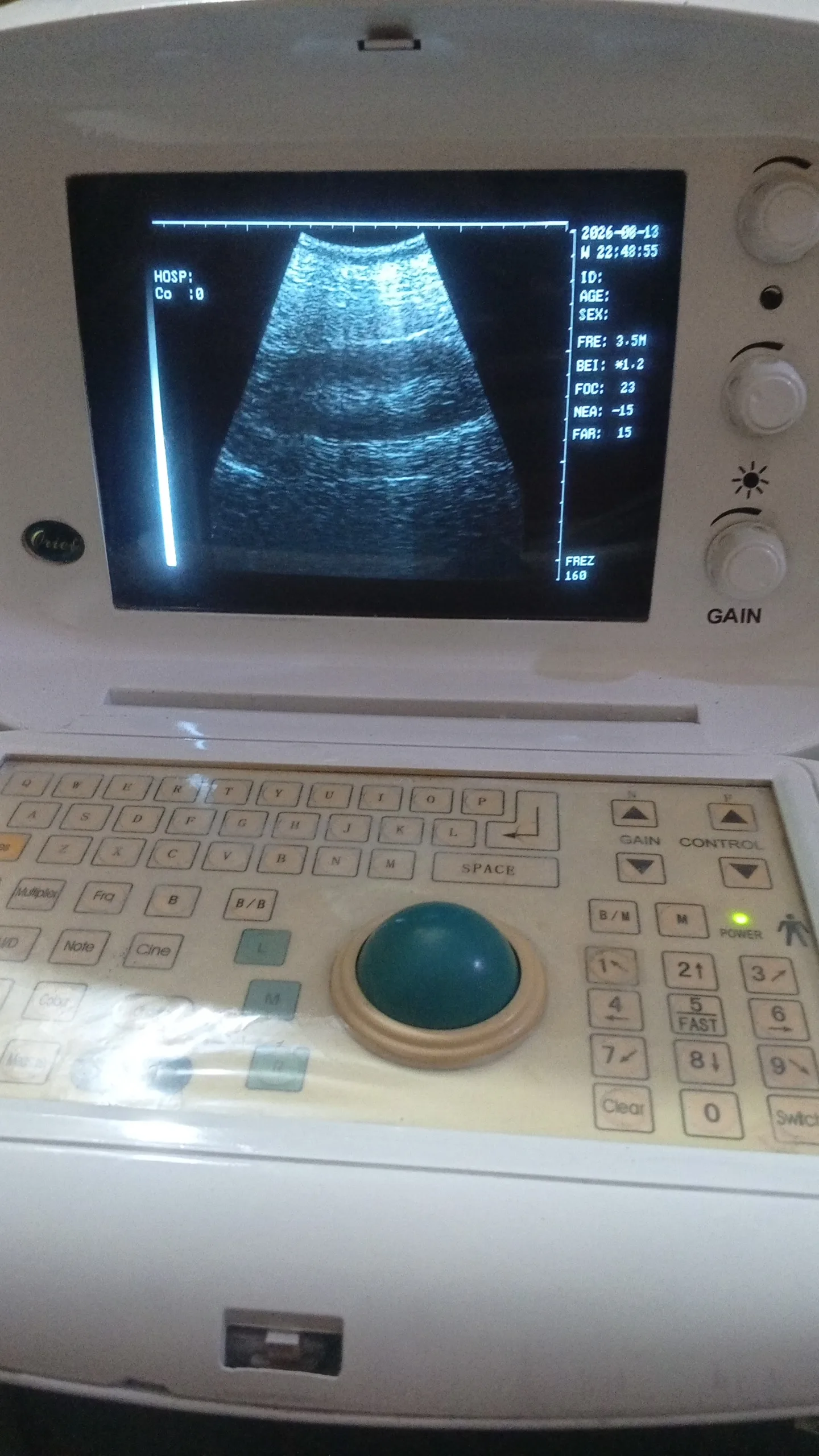 Portable Use ultrasound Machine for sale,