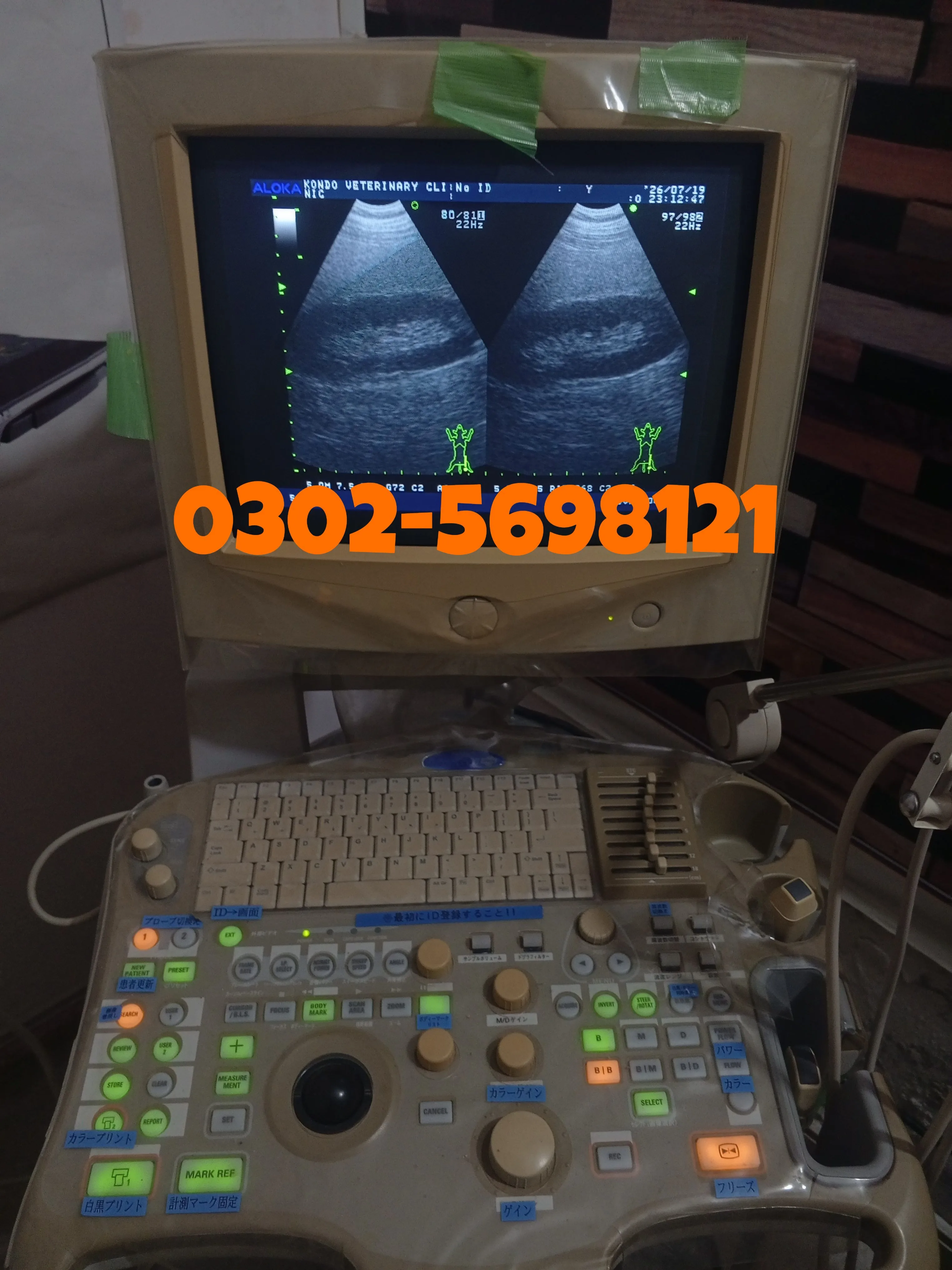 Colour Doppler For Contact; 0302-5698121
